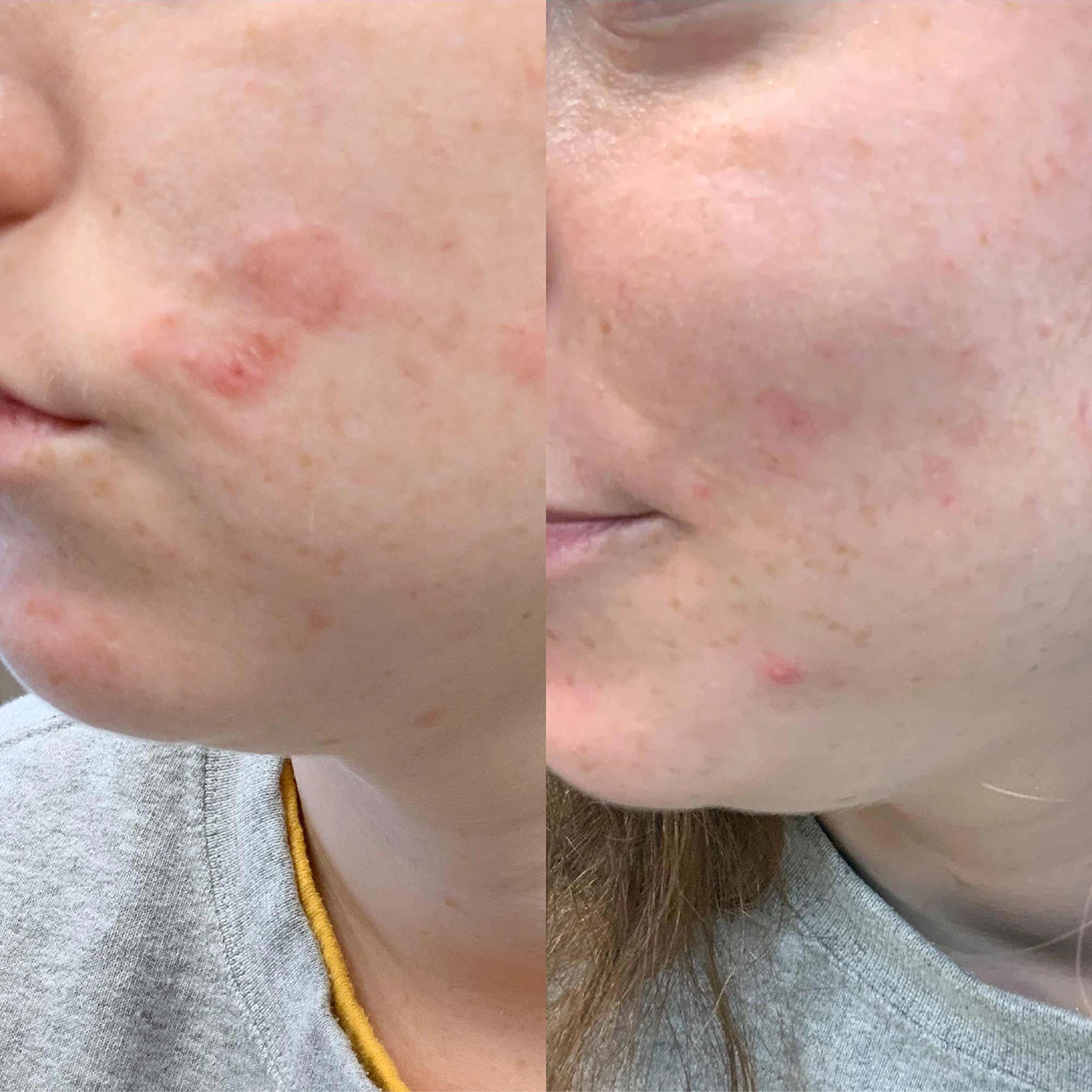 ClearBalm Serum Hydrator