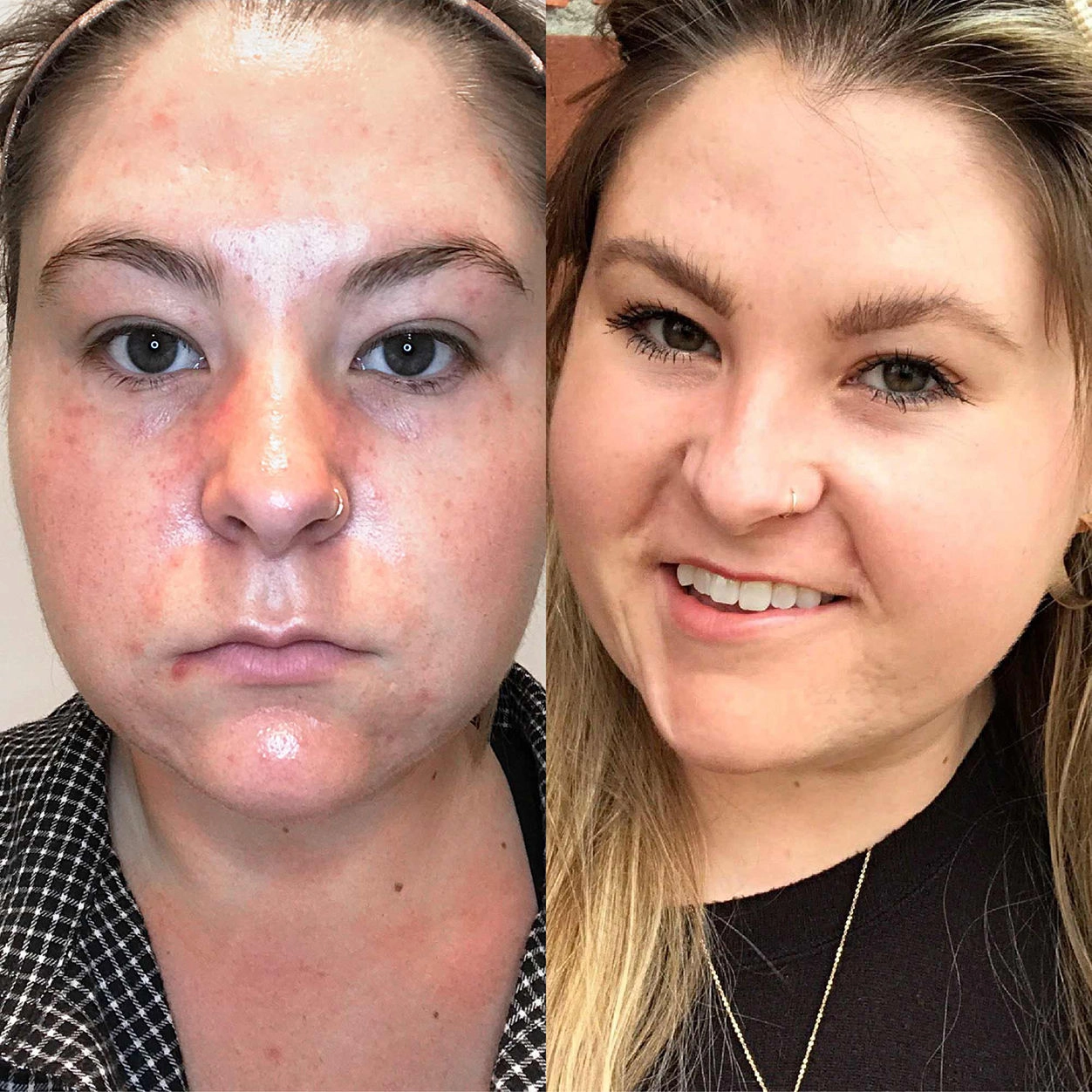 ClearBalm Serum Hydrator